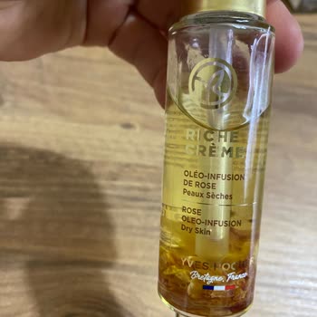 Serumda Kıl Bulunması Hijyen İhlali Ve Ücretsiz Değişim Talebi