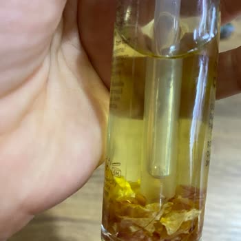 Serumda Kıl Bulunması Hijyen İhlali Ve Ücretsiz Değişim Talebi