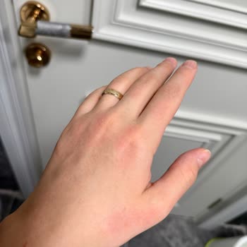 Sleepy Çam Ferahlığı Yüzey Mendili Kullanımında Bebekte Ve Yetişkinlerde Şiddetli Cilt Hassasiyeti