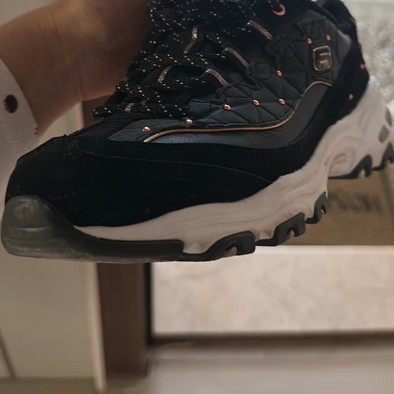 Skechers Ayakkabısında 10 Günde Şiddetli Koku Ve Üretim Kusuru Reddine Karşı İade Talebi