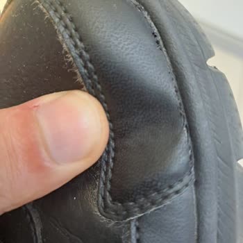 Skechers Ayakkabısında Yırtılma Ve Hakem Heyeti Kararının İhlali