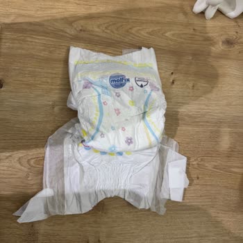 Molfix Bebek Bezinde Eksik Bant, Değişim Talebi