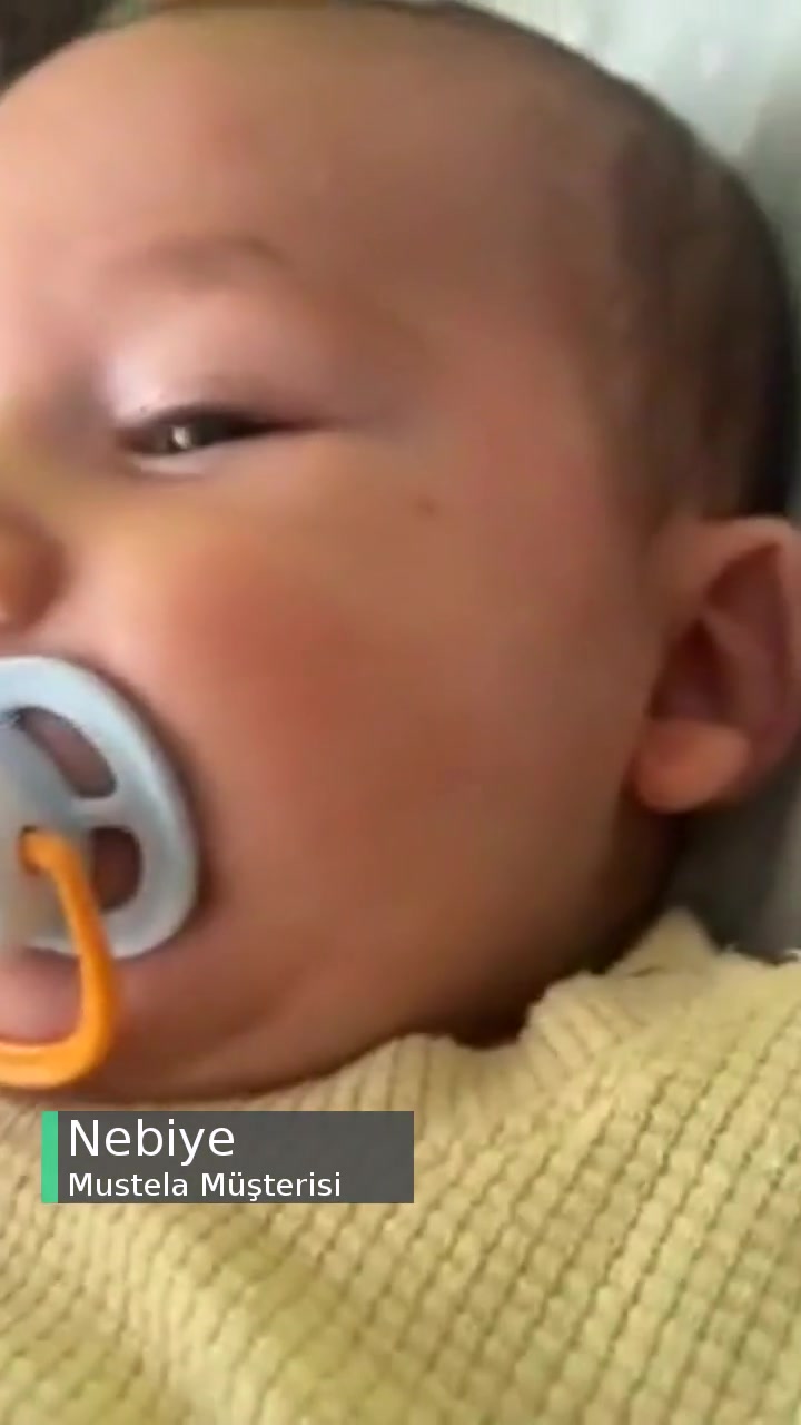 Mustela Kremden Sonra Bebeğimin Cildi Kızardı! videonun kapak resmi