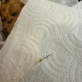 Yemekte Tel Parçası Çıktı Ve Ağız İçinde Kanamaya Neden Oldu