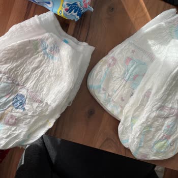 Molfix 6 Numara Külot Bezinde Baskı Ve Ölçü Hatası Nedeniyle Mağduriyet