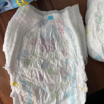 Molfix 6 Numara Külot Bezinde Baskı Ve Ölçü Hatası Nedeniyle Mağduriyet