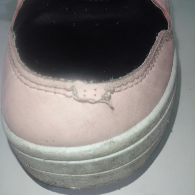 Art Bella Botunun Dikişleri Açıldı, Mağaza Değişim Ve İade Reddetti