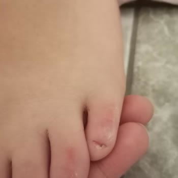 Sert Bot Tabanı Çocuğumun Ayaklarını Yaraladı Ve Mağaza İnceleme Süreci Uzadı