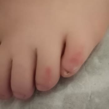 Sert Bot Tabanı Çocuğumun Ayaklarını Yaraladı Ve Mağaza İnceleme Süreci Uzadı