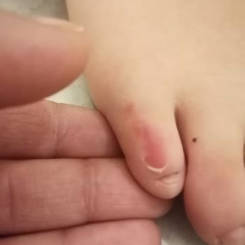 Sert Bot Tabanı Çocuğumun Ayaklarını Yaraladı Ve Mağaza İnceleme Süreci Uzadı