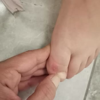 Sert Bot Tabanı Çocuğumun Ayaklarını Yaraladı Ve Mağaza İnceleme Süreci Uzadı