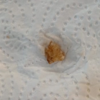 Torku Çıtır Gofret İçinde Yabancı Cisim Çıktı Dişimi Kırma Tehlikesi Yaratıyor