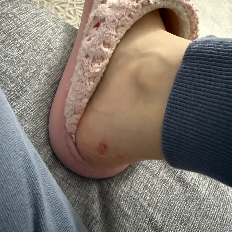 Yan Kısmı Çökmüş Botta Ayak Yarası Ve Mağaza Çözüm Sunmuyor