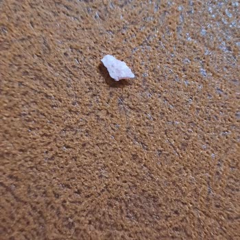 Getir Ve Namet'e Kemik Parçası İçeren Salam Nedeniyle Diş Kırılması