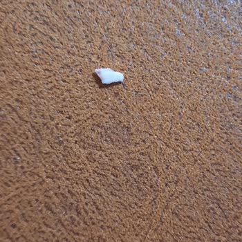 Getir Ve Namet'e Kemik Parçası İçeren Salam Nedeniyle Diş Kırılması