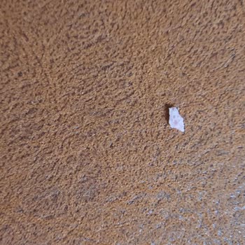 Getir Ve Namet'e Kemik Parçası İçeren Salam Nedeniyle Diş Kırılması