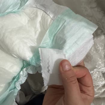 Bebek Bezinde Dört Yerden Kopma, 319 TL İade Bekliyor