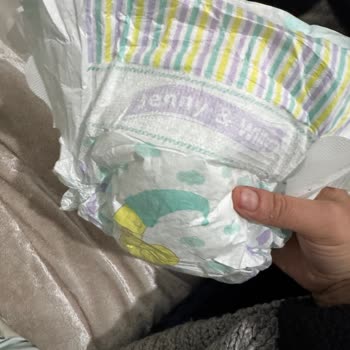 Bebek Bezinde Dört Yerden Kopma, 319 TL İade Bekliyor