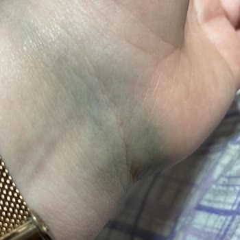 Lujo Aksesuar Çelik Takıların Renk Atması Ve Ciltte Yeşillenmesi