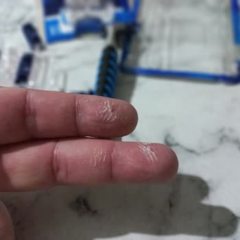 Defolu Gillette Bıçakları Yüzümde Kesik Bıraktı Ve Sağlığımı Tehdit Etti