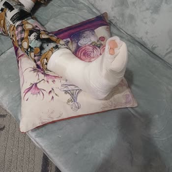 Evkur Çocuk Gardırobunda Gevşeyen Menteşeler Çocuğumun Ayağını Kırdı, 3 Hafta Geri Dönüş Yok