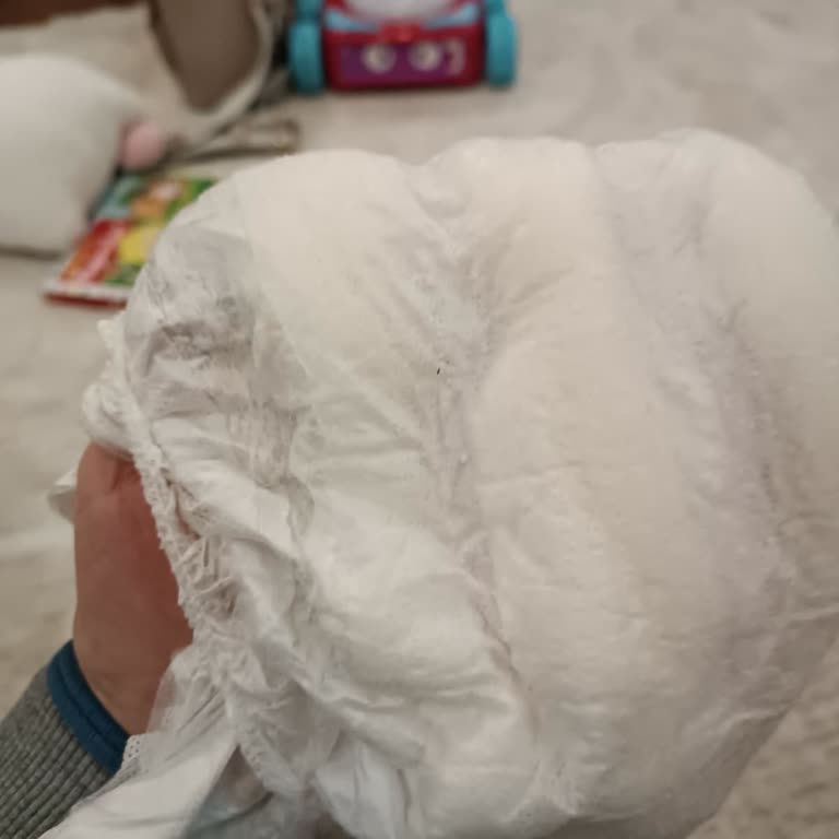 Molfix Bebek Bezinde İç Bariyer Parçaları Dökülerek Cilt Tahrişi Yarattı