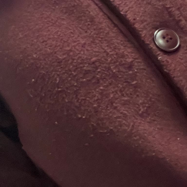 Kısa Sürede Tüylenen Kaban Ve Duyarsız Müşteri Hizmetleri