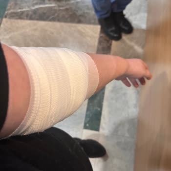 Medicana Sağlık Grubu Engelli Hastada Uzun Bekleme Ve Yanlış Damar Açma Sorunu