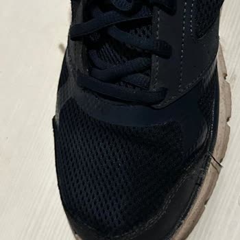 Skechers Ayakkabısında Dikiş Açılması Ve Garanti Reddi