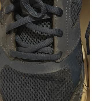 Skechers Ayakkabısında Dikiş Açılması Ve Garanti Reddi