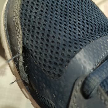 Skechers Ayakkabısında Dikiş Açılması Ve Garanti Reddi