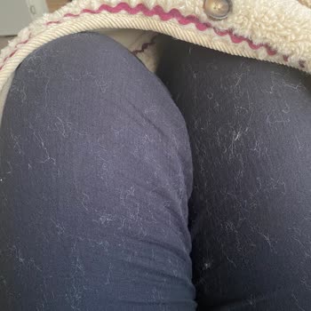 Zara Çocuk Montunda Aşırı Tüy Dökülmesi Ve İade Talebi