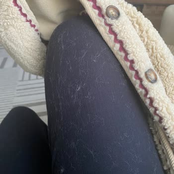 Zara Çocuk Montunda Aşırı Tüy Dökülmesi Ve İade Talebi