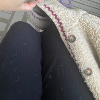 Zara Çocuk Montunda Aşırı Tüy Dökülmesi Ve İade Talebi