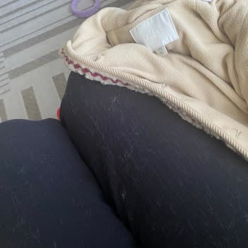 Zara Çocuk Montunda Aşırı Tüy Dökülmesi Ve İade Talebi