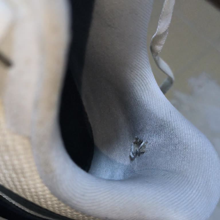 Intersport Ayakkabının İç Astarı 6 Ayda Yırtıldı Ve Kullanıcı Hatası İddiası