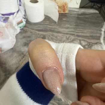 O’lâ Nail & Beauty Yaşadığım Sağlık Problemi Ve İlgisiz, Kaba Tutum!