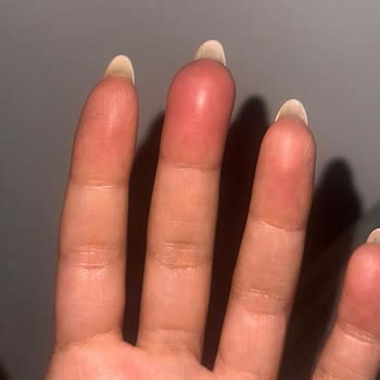 Minas Nail Studio Manikür Mağduriyeti