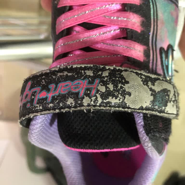 Skechers Çocuk Ayakkabısında Kısa Sürede Üst Kapak Soyulması Ve Kalite Sorunu