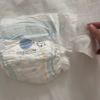 Molfix Premium Bebek Bezinde Yırtık Cırt Cırt Sorunu Ve Değişim Talebi