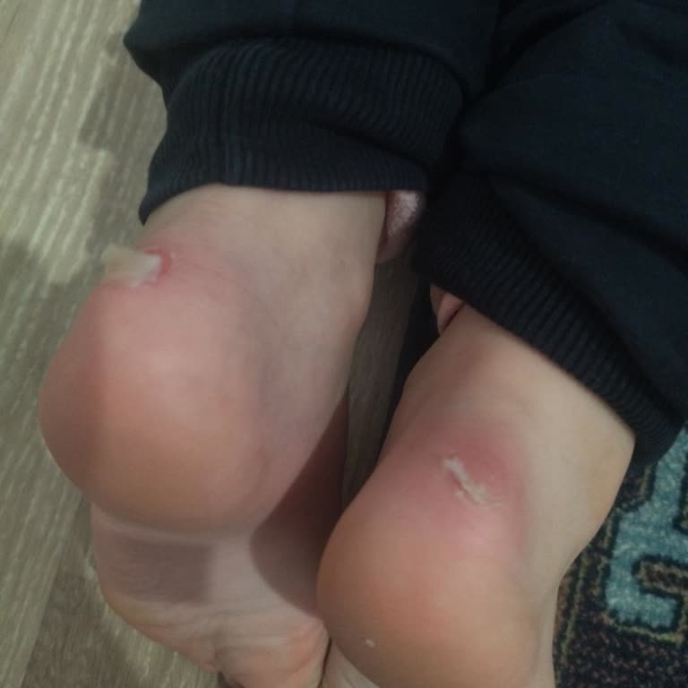 Çocuk Ayakkabısı Ayağı Vurdu, Değişim Talebi