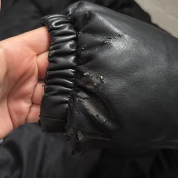 Deri Montumun Deri Dökülmesi Ve Mağaza Yardım İhmali