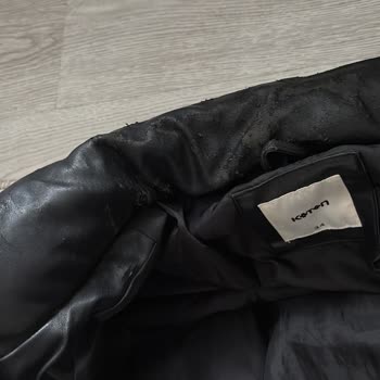 Deri Montumun Deri Dökülmesi Ve Mağaza Yardım İhmali