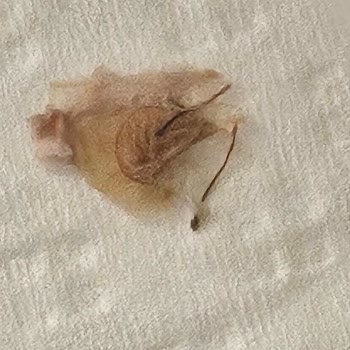 Tamek Ahududu Reçelindeki Dehşet Verici Görünüm Marka Güvenini Sarsıyor