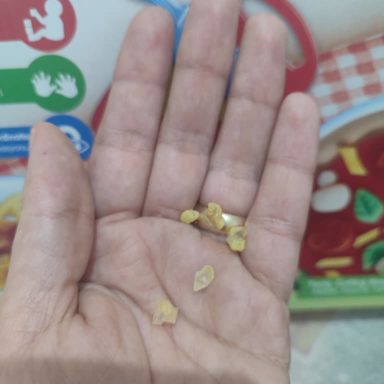 Sert Oyun Hamuru Ve İçindeki Sivri Parçalar Çocuk Güvenliğini Tehlikeye Atıyor