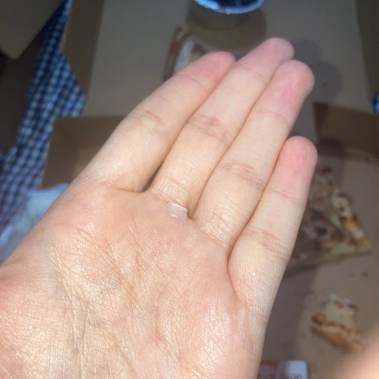 Kaşarlı Pidede Cam Parçası: Aile Üyesi Neredeyse Boğazına Takıldı