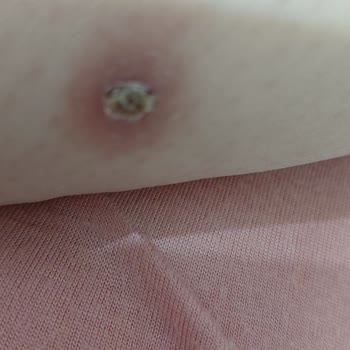 Sivas FLO Mağazasındaki Ayakkabı Aşırı Sıkıyor Ve Yara Bırakıyor