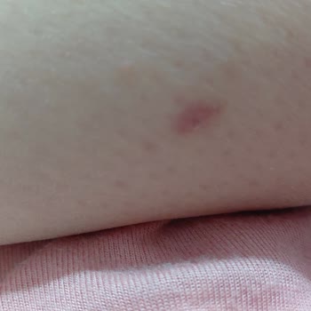 Sivas FLO Mağazasındaki Ayakkabı Aşırı Sıkıyor Ve Yara Bırakıyor