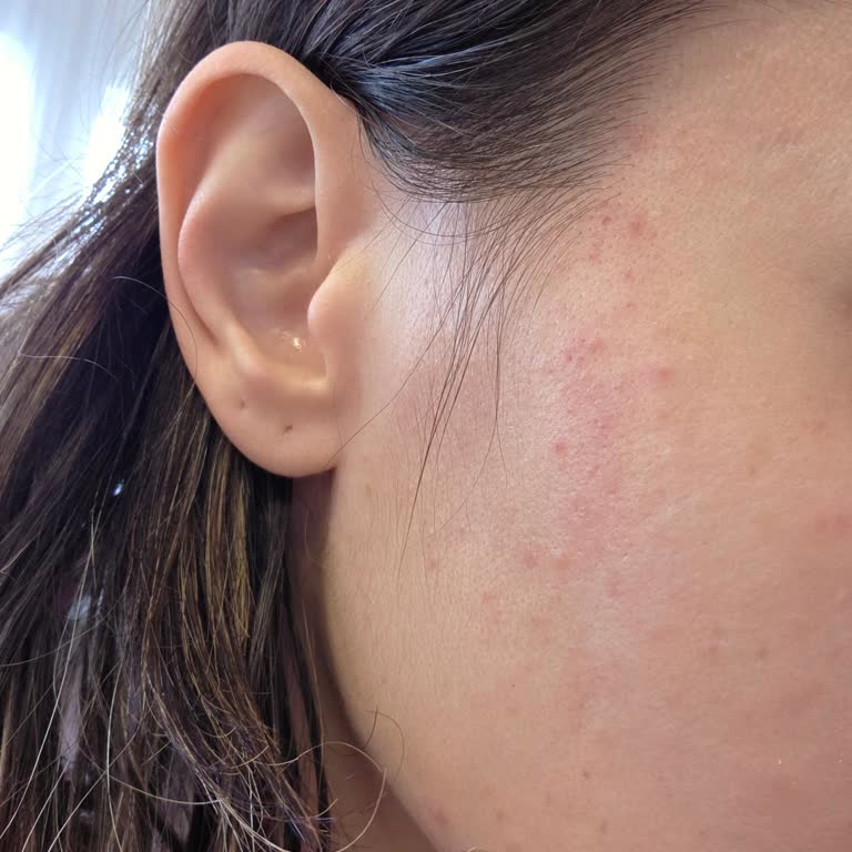 Amerikan Cilt Bakımı Sırasında Yanma Ve Kırmızı Lekeler, İade Talebi