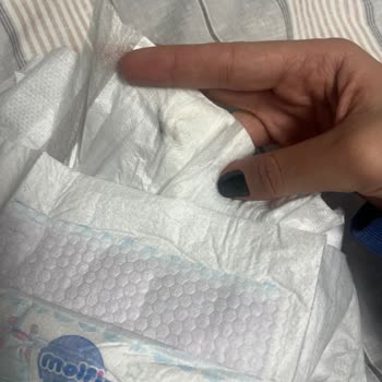 Molfix Bebek Bezi İçinde Sert Cisim Tespiti Ve Üretim Hatası Şikayeti